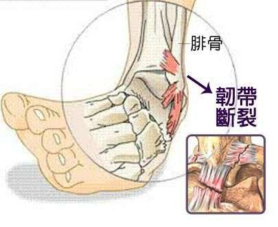 如何正确拉韧带,并且不会受伤?