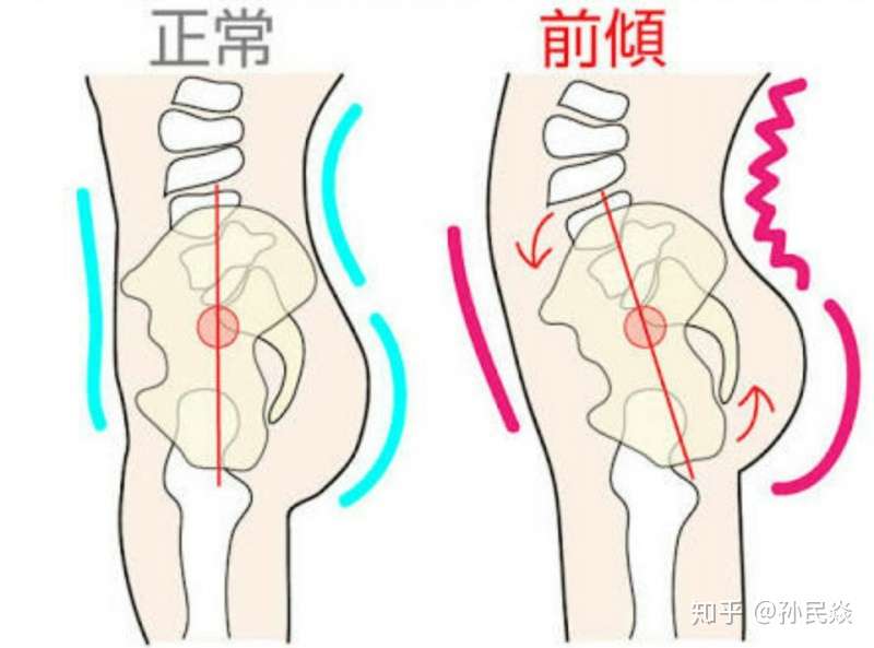 翘臀与身体结构的关系 知乎