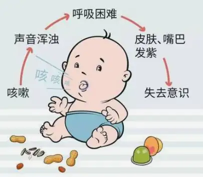 小儿维生素 d 缺乏性手足搐搦症早期有什么常见的症状?