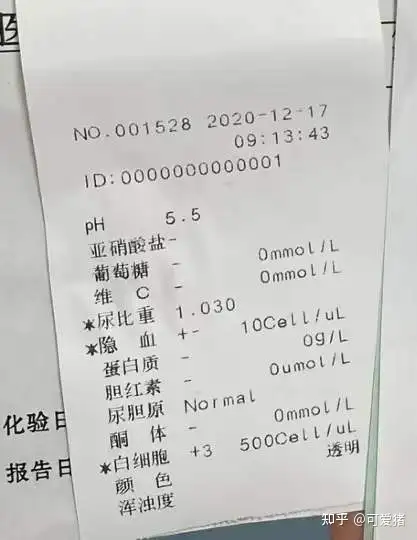 尿胆原阳性 zhuanlan.zhihu.com