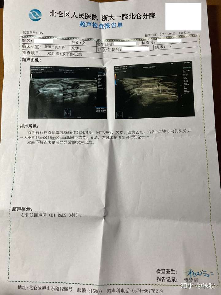 当诊断出乳腺结节时我在想什么