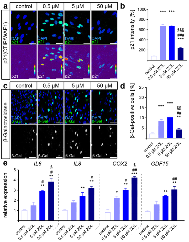 GDF15 調(diào)節(jié)唑來(lái)膦酸誘導(dǎo)的牙周膜成纖維細(xì)胞的高炎機(jī)械反應(yīng)