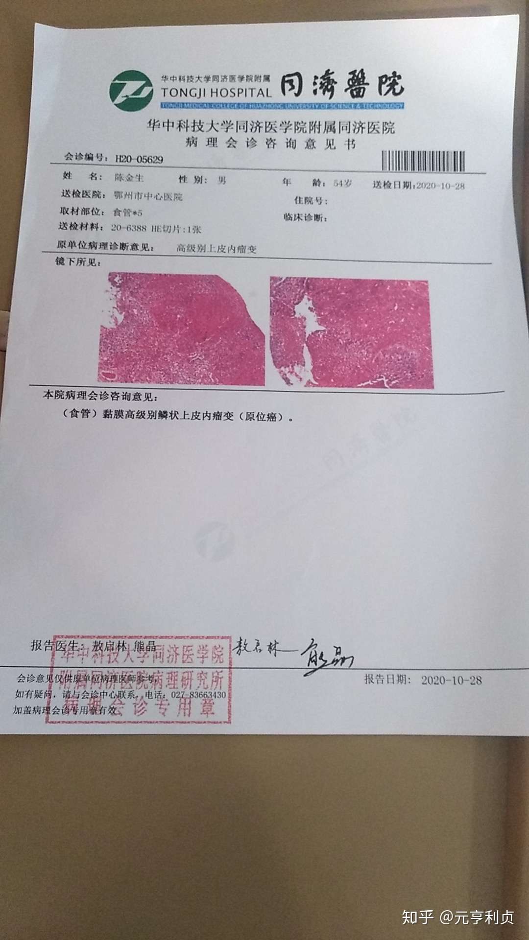 救救我父亲 帮帮我这个家庭 我们的父亲不可以倒下 知乎