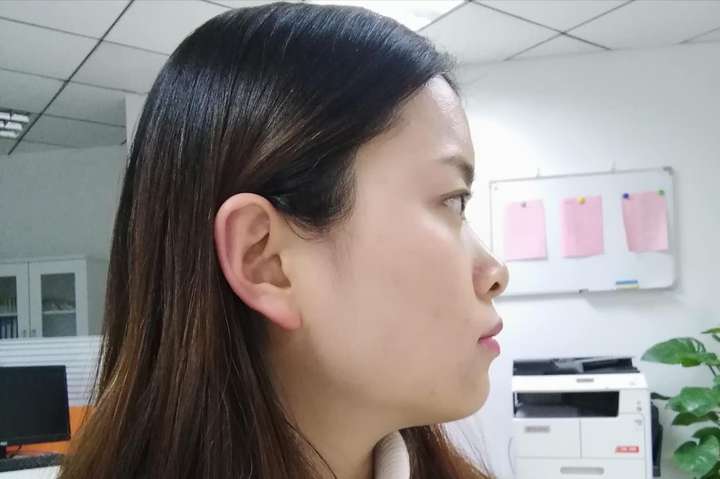 正脸好看,侧脸丑哭是种什么样的体验?