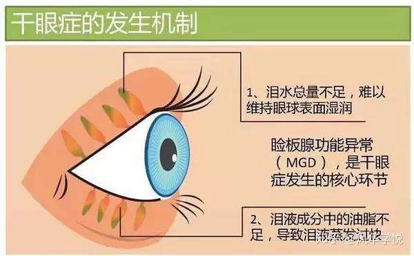 其实,人的眼睛表面有一层泪膜覆盖,不哭的时候也有基础的泪液分泌来