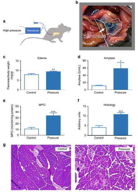 Piezo1是一種介導壓力誘導胰腺炎的機械激活離子通道