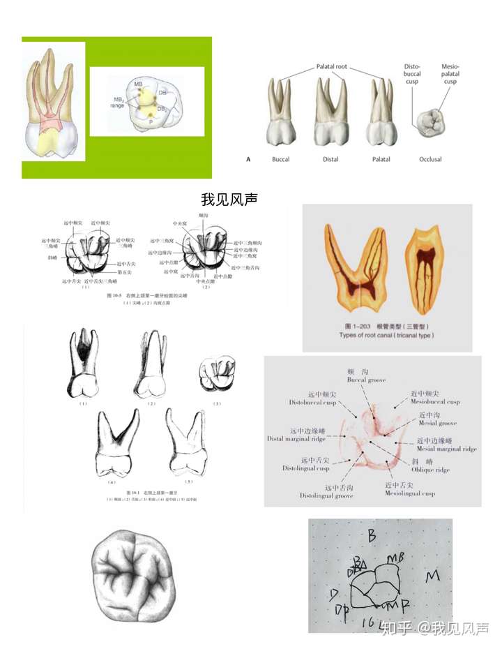 下颌七根管分布图图片