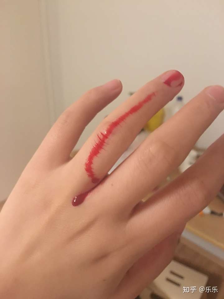 仓鼠因为我把睡觉的它吵醒了,开始咬我,怎么办?