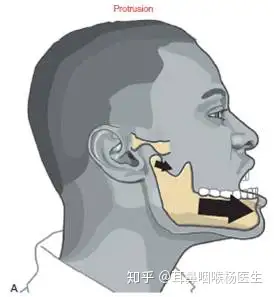 现实生活中掉下巴真的会发生