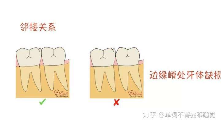 如果去医院把牙缝封起来是不是就不会塞牙了人为什么牙齿是一颗颗的一