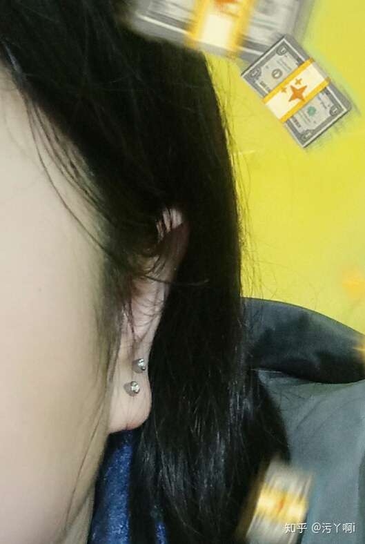 冬天打耳洞会冻坏吗?