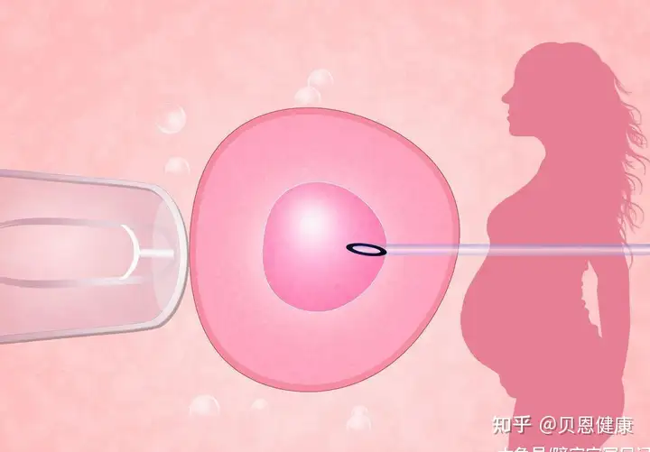 多少钱可以在成都借卵（单亲妈妈做试管婴儿合法吗?）