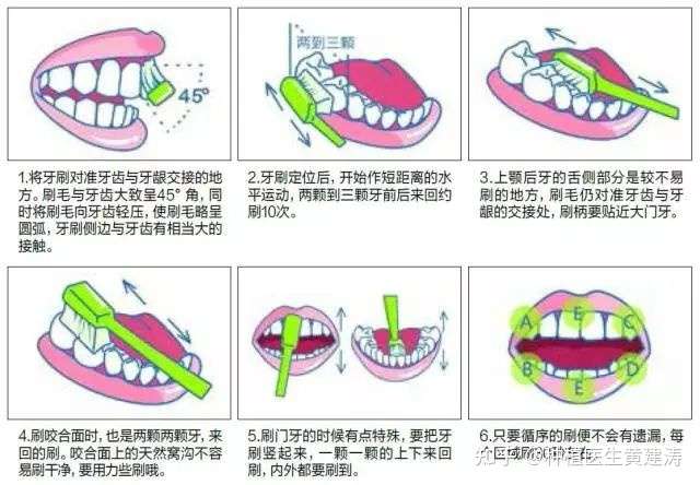 巴氏刷牙法图解,来源于网络