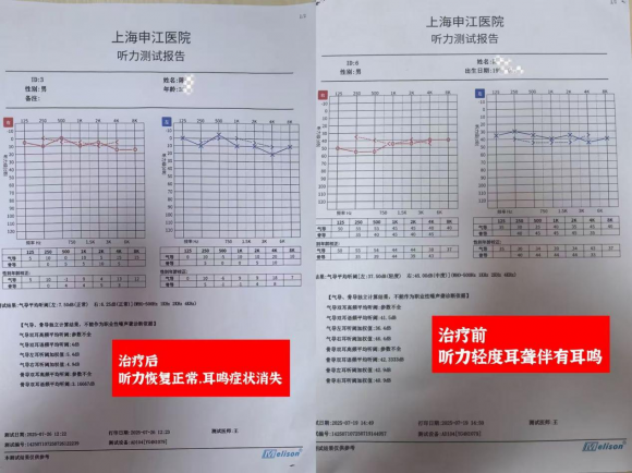 上海申江耳聋耳鸣医院正规吗？专注专治耳聋耳鸣：用专注成就专业(图1)