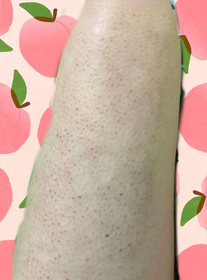 打败鸡皮肤教程(打败鸡皮肤教程图片) 打败鸡皮肤教程(打败鸡皮肤教程图片)