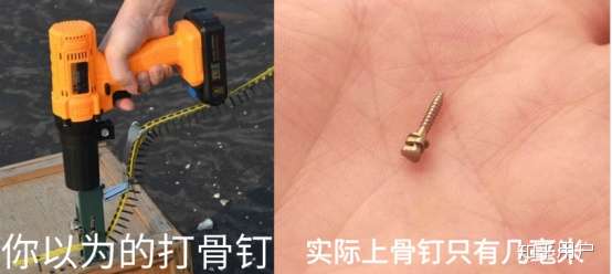 正畸时,打了骨钉的你们都什么感觉?