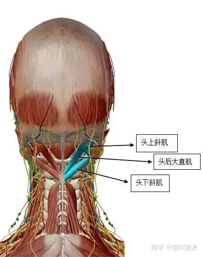 頸椎生理曲度變直引起的頭痛如何根治