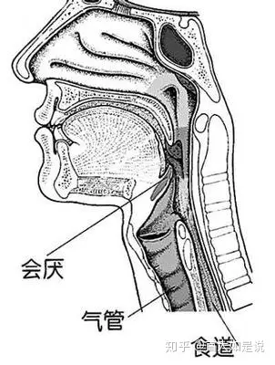 首大李健东一个容易被忽视的疾病会厌囊肿