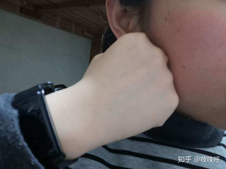 为什么我的手很白,脸却又黑又黄?怎么才能改善?