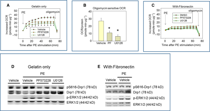 粘着斑激酶（FAK）通过动力蛋白相关蛋白1（Drp1）调控心肌细胞线粒体裂变和功能