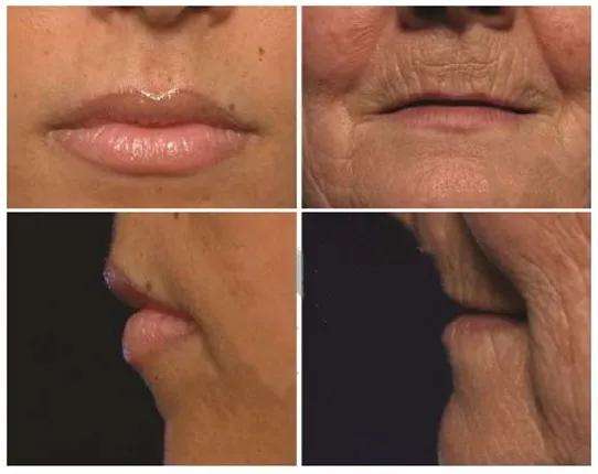 薄唇不好看的原因找到啦