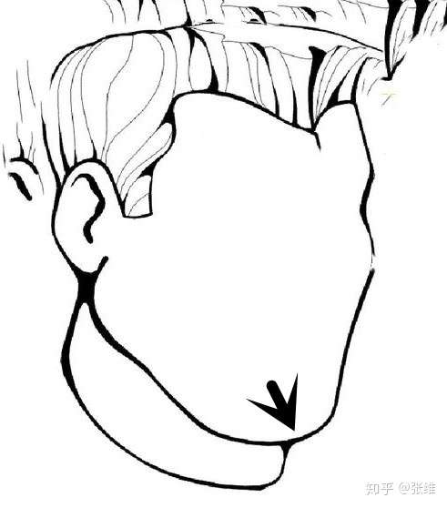 男士整容——下巴!