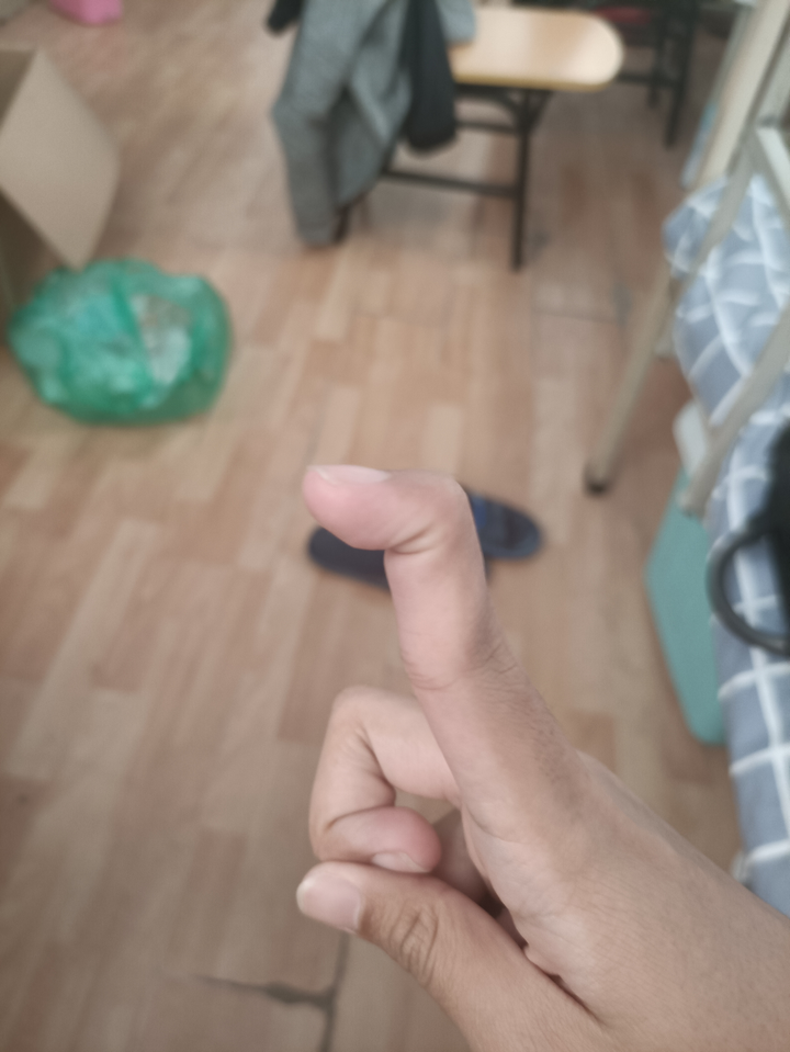 请问我的手为什么能做出这样扭曲的动作,这是否是一种性状?