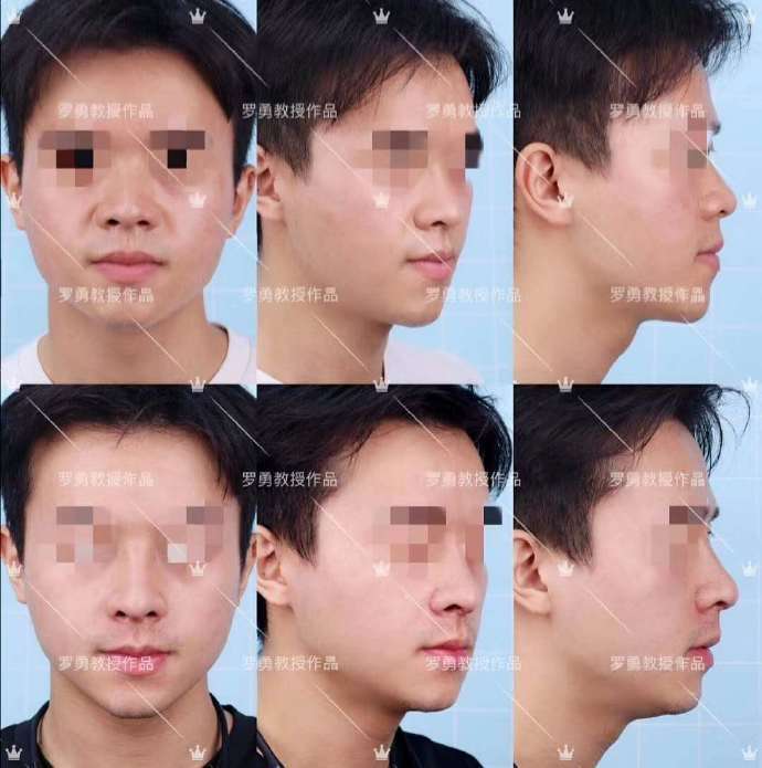 什么样的鼻子好看 这四种鼻子必须要知道 知乎