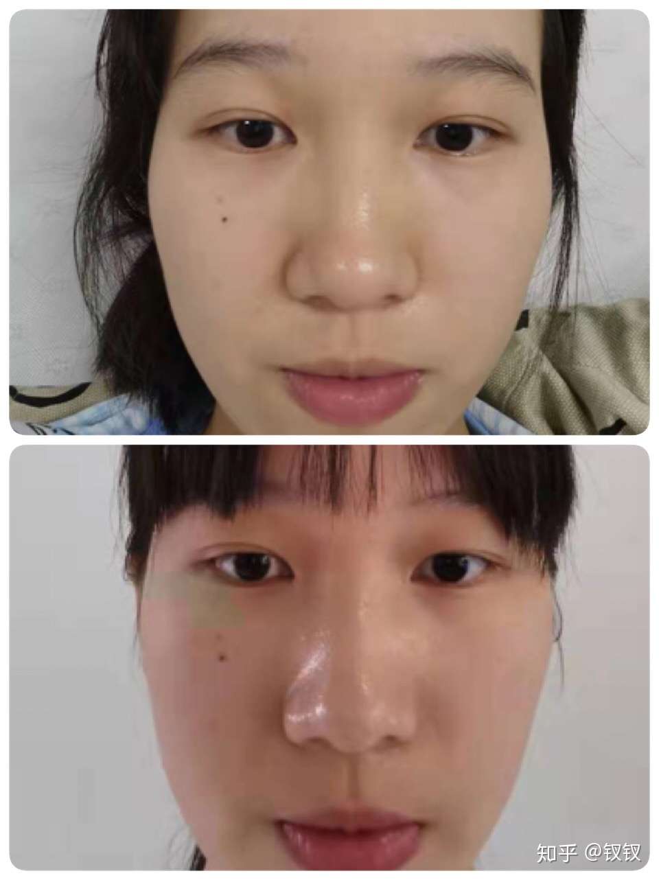 想瘦鼻的妹子看过来 知乎