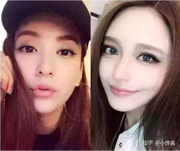听说日本也有很多女星整容 为什么看起来日本女星整容比韩国的自然很多 但是好像国内很少有人去日本整容 知乎 听说日本也有很多女星整容 为什么看起来日本女星整容比韩国的自然很多 但是好像国内很少有人去日本整容 知乎