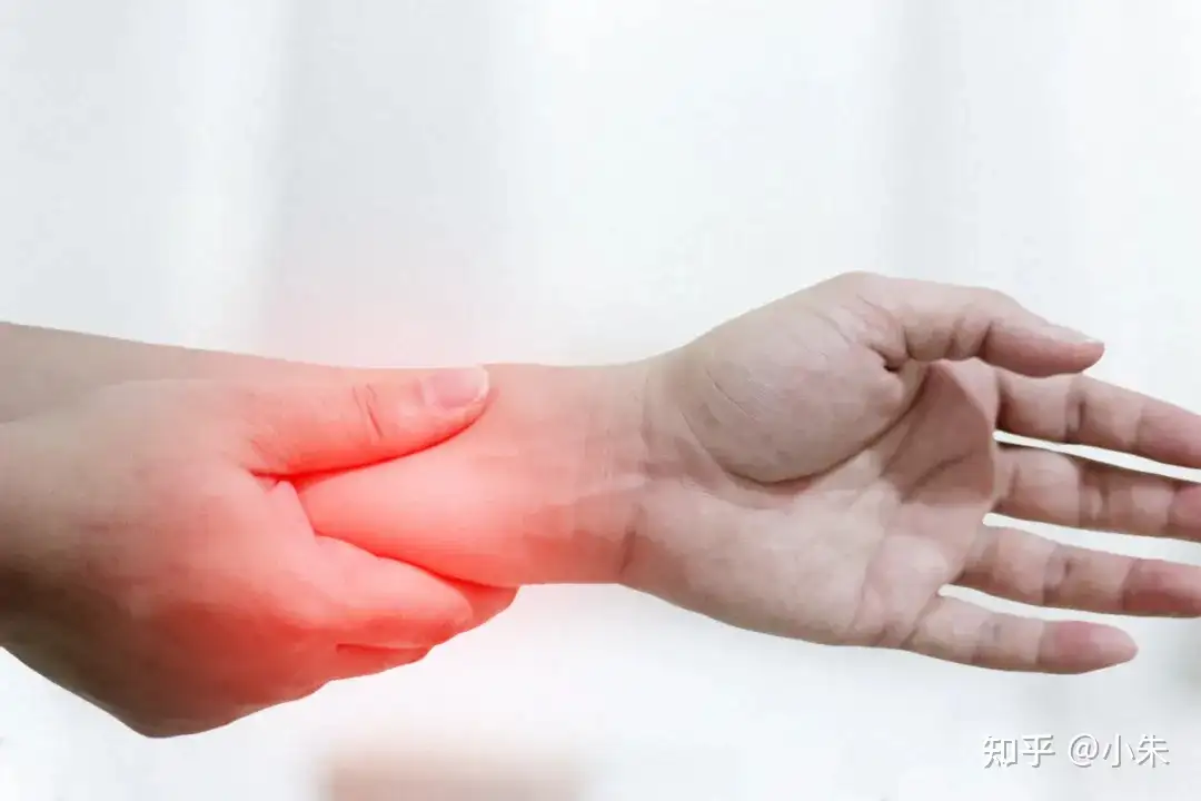 经常觉得手麻 到底是什么原因 真不是 缓一缓就好了 这么简单 知乎