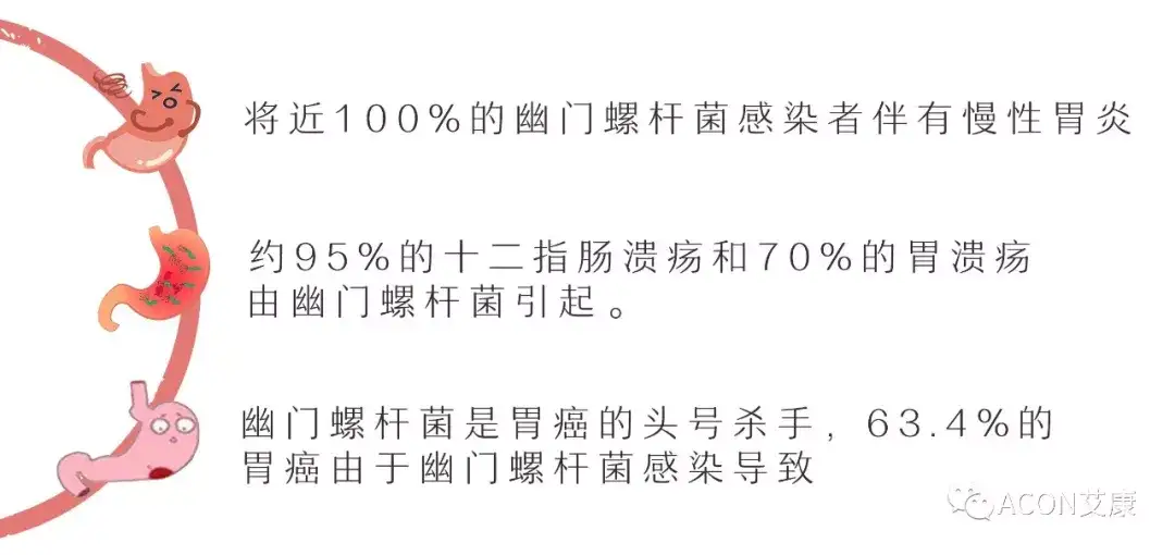 有这几种症状 你可能已感染了幽门螺杆菌 知乎