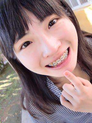 带牙套的女生如何拍出好看的写真?