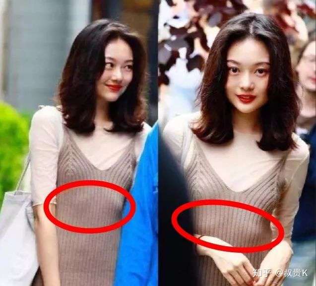 肋骨外翻可以有好身材么