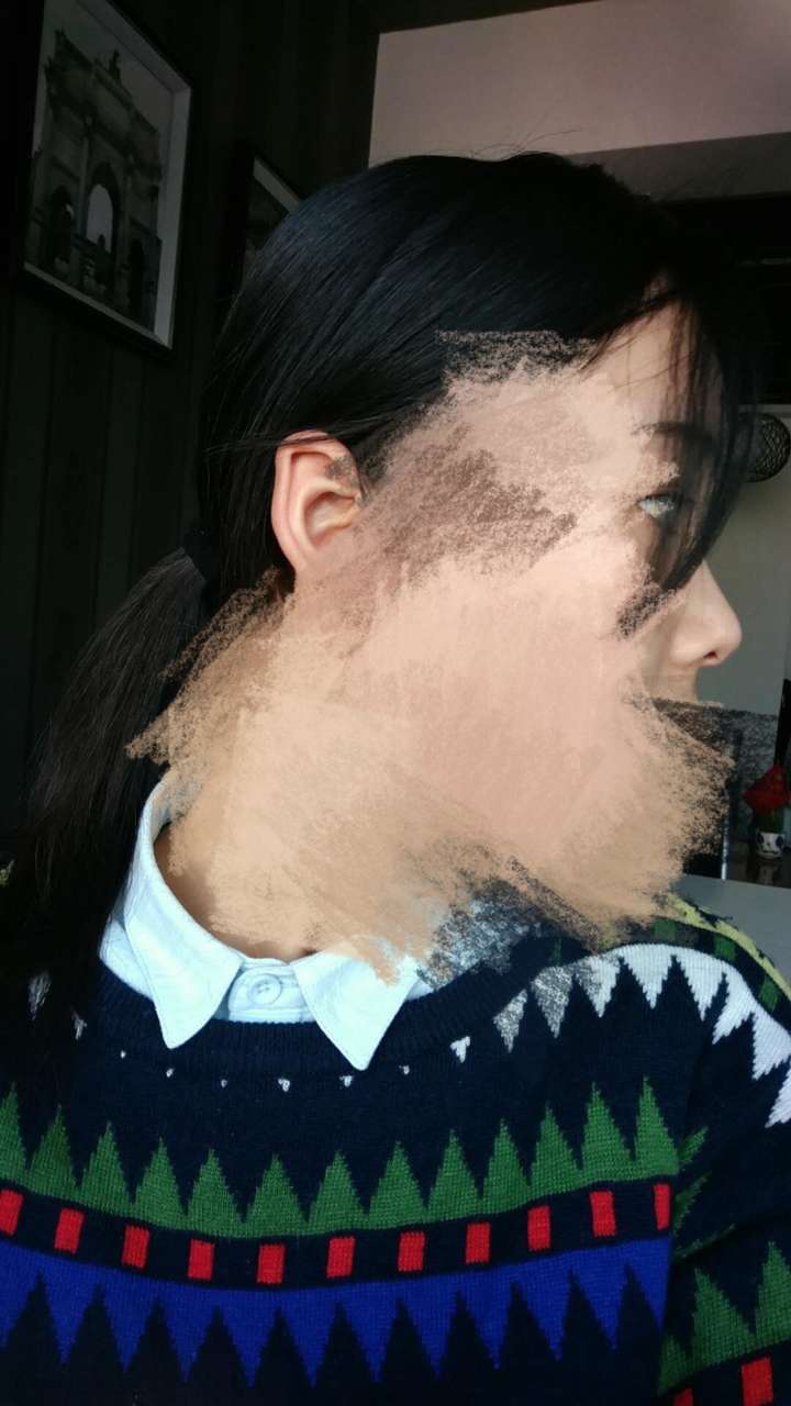 鼻梁塌没有山根的女生想要变得可爱除去整容还有什么办法