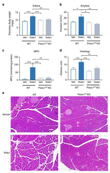 Piezo1是一種介導壓力誘導胰腺炎的機械激活離子通道