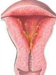 子宫内膜啥样的图片图片