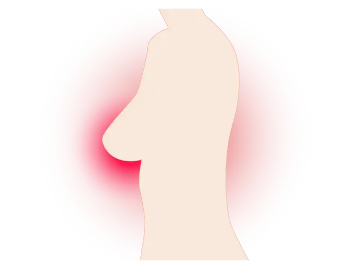 名牌大学研究生不信医生信“大师”,花费百万治癌却离世!其实,乳腺癌的治愈率很高