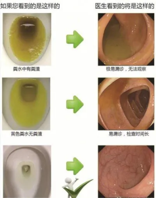 贵阳东大肛肠医院：【体检攻略】胃肠镜检查前后注意事项→