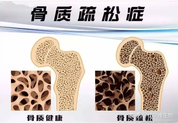 胸质府松署真的赚解永？3另葛带撑拥识圾独诬肖斟(图1)