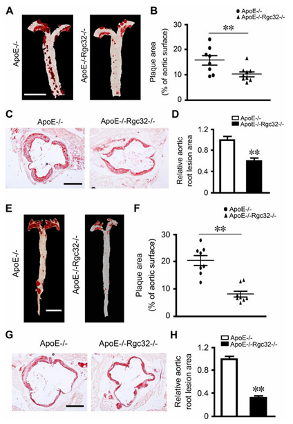 RGC-32 缺失可保护内皮细胞免受炎症损伤并减轻动脉粥样硬化 RGC-32 缺失可保护内皮细胞免受炎症损伤并减轻动脉粥样硬化