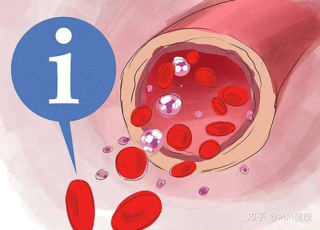 身体出现这6个 变化 是血栓前兆 可惜很多人都忽视了 知乎