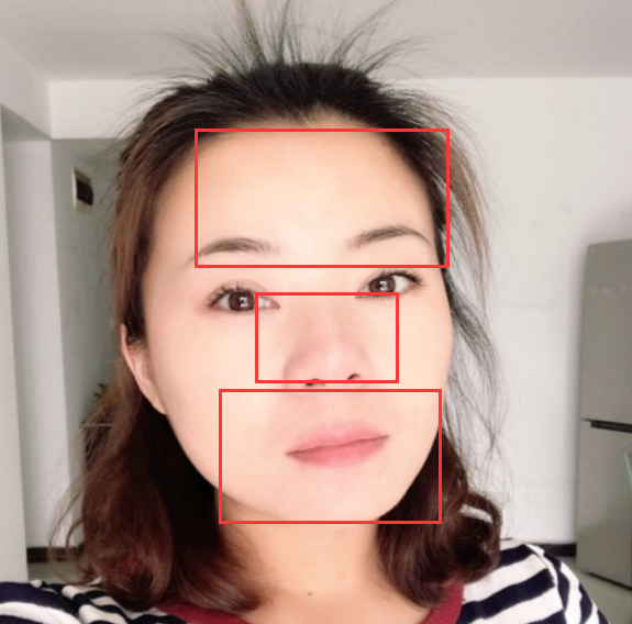 人中太长了该怎么办?该做鼻子还是上唇呢?