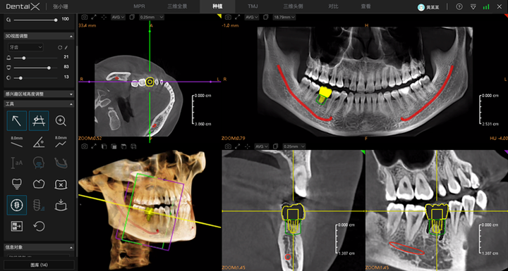 引领口腔行业数字化升级,睿知影口腔智能影像服务,重磅上线
