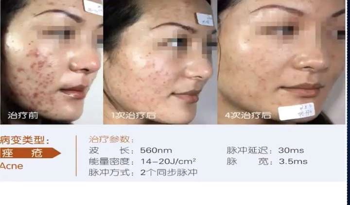 医美的效果强大到真的会上瘾(图10) 医美的效果强大到真的会上瘾(图10)