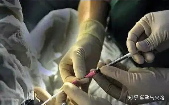 成都三代试管成功率（直击试管婴儿的过程）