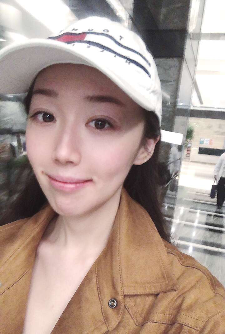 医美的效果强大到真的会上瘾(图31) 医美的效果强大到真的会上瘾(图32)