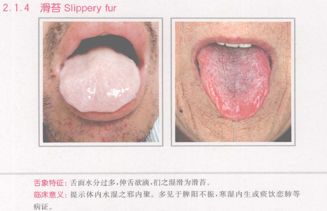 滑苔和腻苔区别?