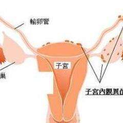 v2-bc1401debc0aba646f257d6d3629e10a_qhd.jpg
