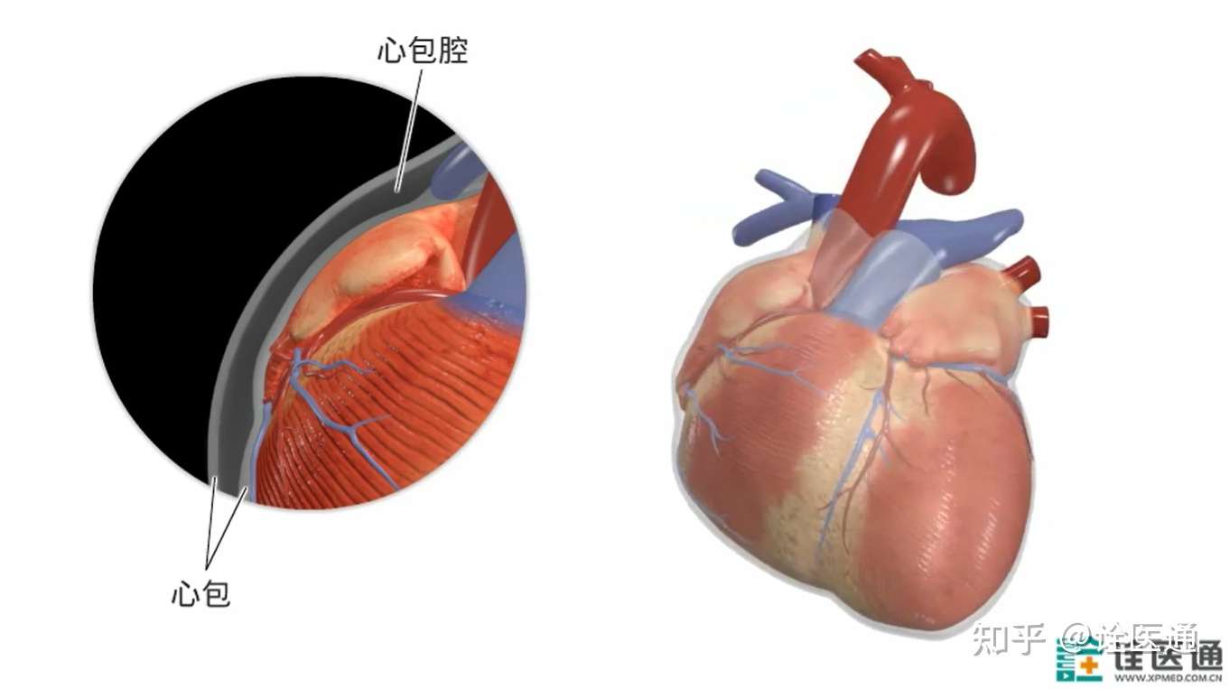 心包穿刺术怎么做 知乎